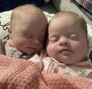 Mom of rare twins with Down syndrome shuts down critics with photo showing how beautiful they are