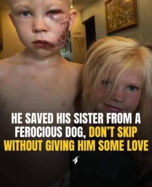 HE SAVED HLS SISTER FROM A FEROCIOUS DOG