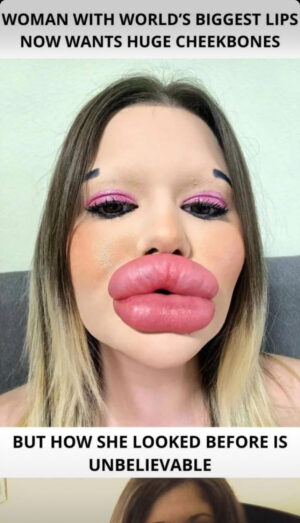 The individual boasting the largest lips on the planet!