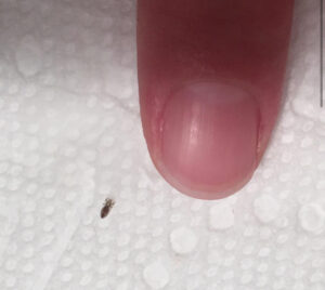 How To Keep Head Lice Away From Children (And Adults!)