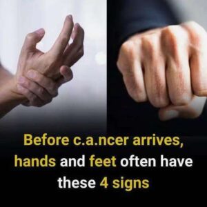 4 Early Warning Signs in Your Hands and Feet You Should Never Ignore