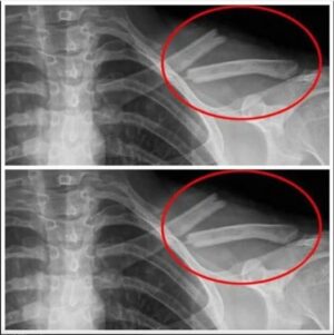 🧪 This Poison Has the Potential to Destroy Your Bone — Here’s What You Need to Know