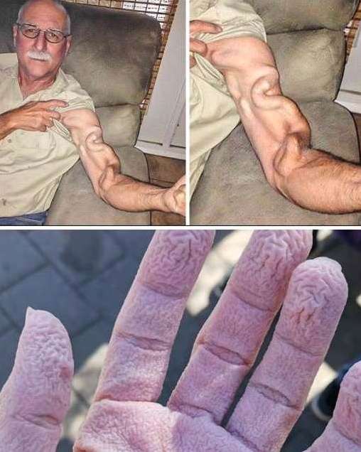 A man tried to stretch but suddenly felt a sharp pain in his arm—what happened next will surprise you