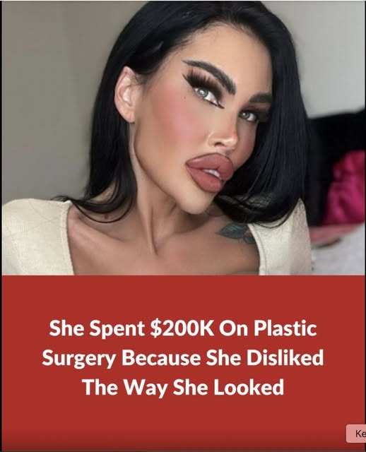 Plastic surgery addict spends $200K on plastic surgery