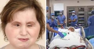 The amazing story of Katie Stubblefield: She became the youngest person to receive a face transplant