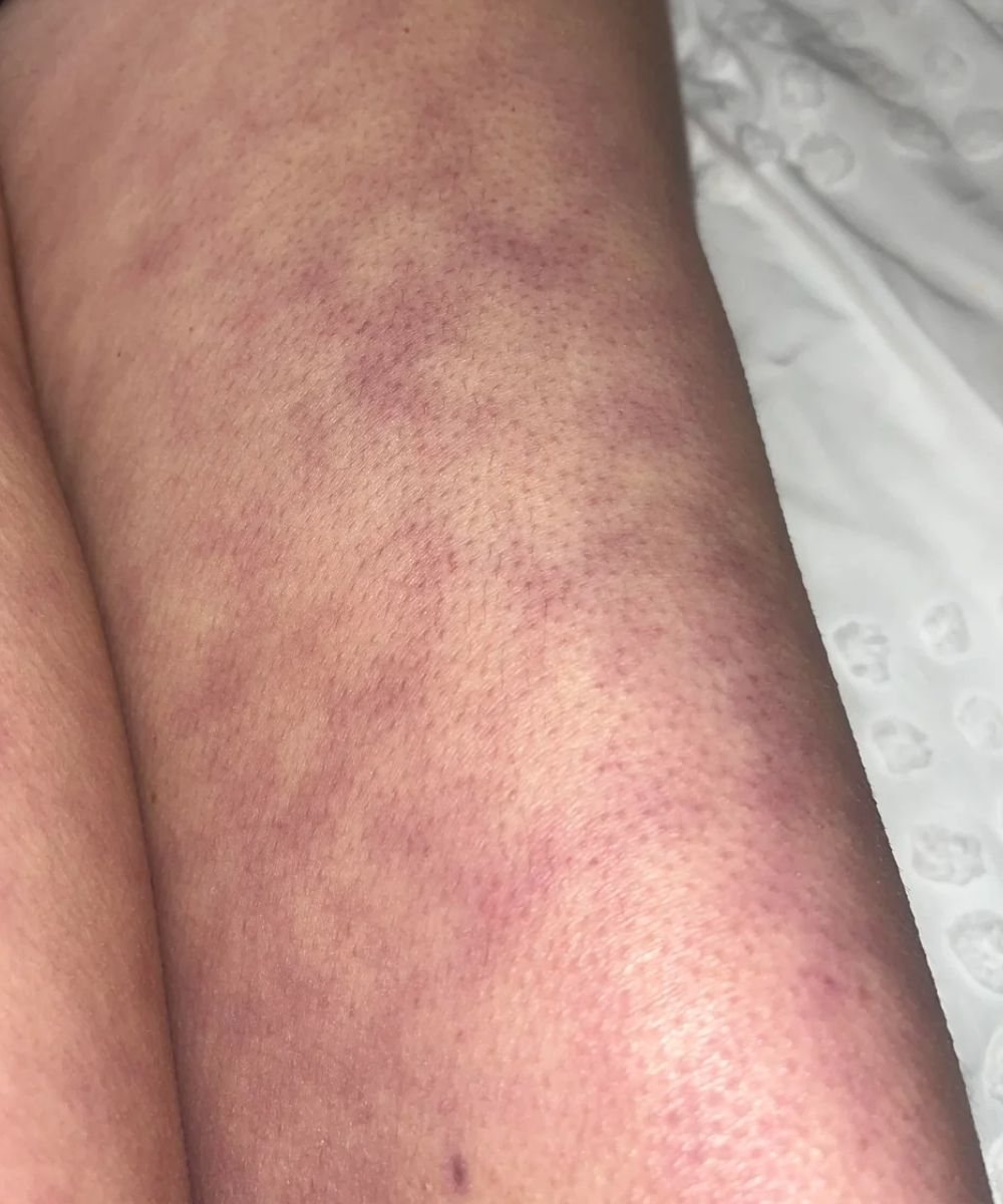 What those strange skin patterns might really mean
