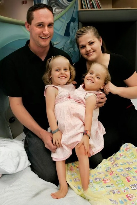 From Conjoined at Birth to Thriving at 19: The Inspiring Story of Kendra and Maliah