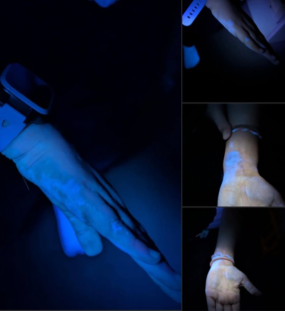 What’s Glowing on My Kid’s Hands?